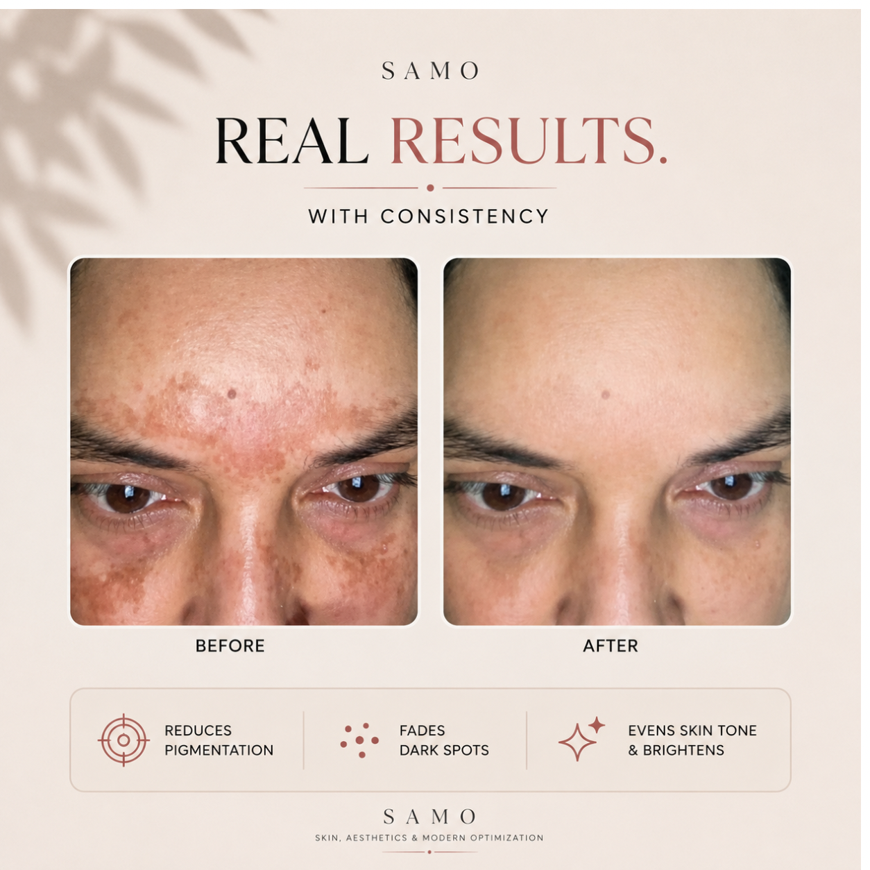 Lumi Reset – Pigmentation & Dark Spot Correcting Cream