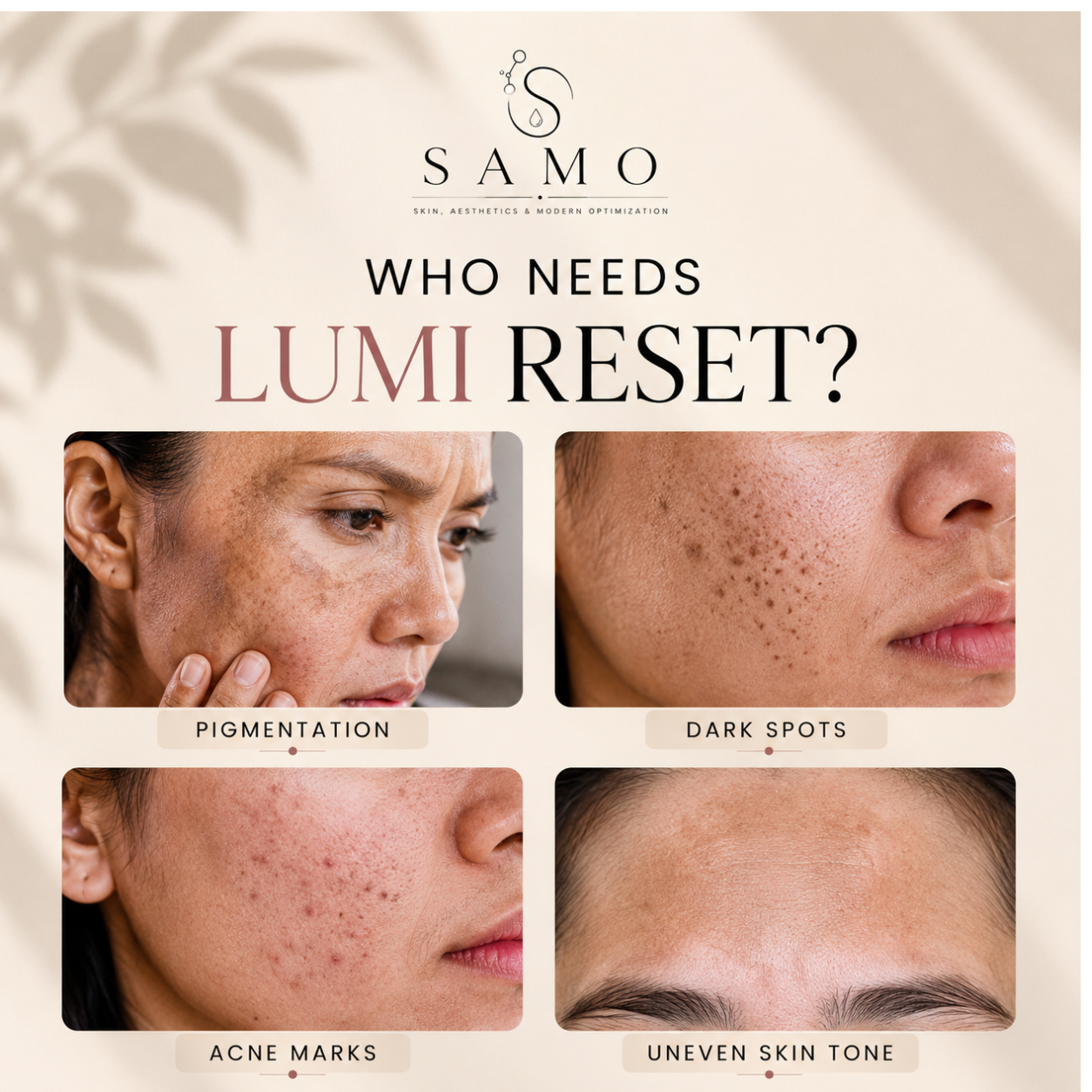 Lumi Reset – Pigmentation & Dark Spot Correcting Cream