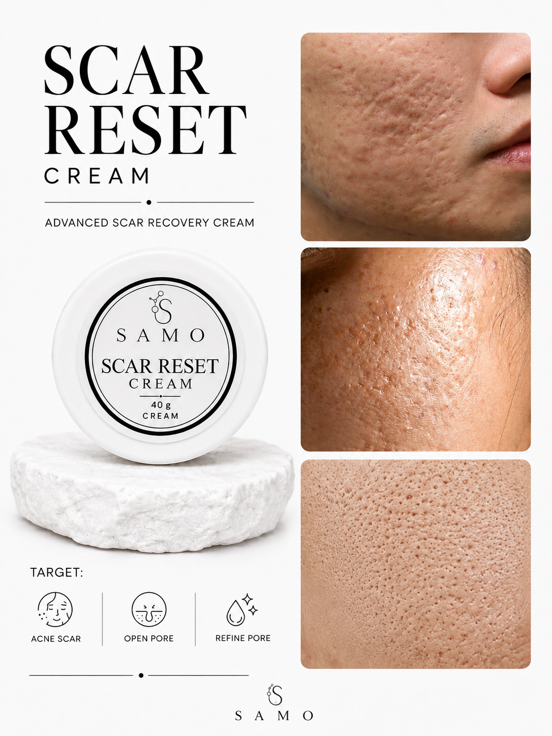 Scar Reset – Advanced Scar Recovery Cream